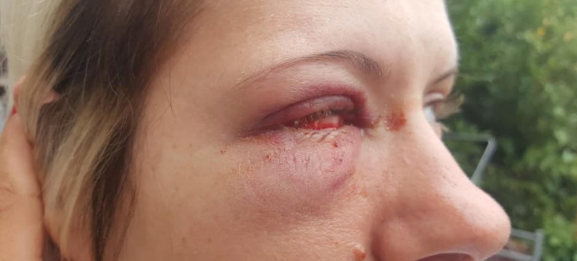 Brutalny atak na Polkę w Wielkiej Brytanii. Dostała za to, że jest z Polski!