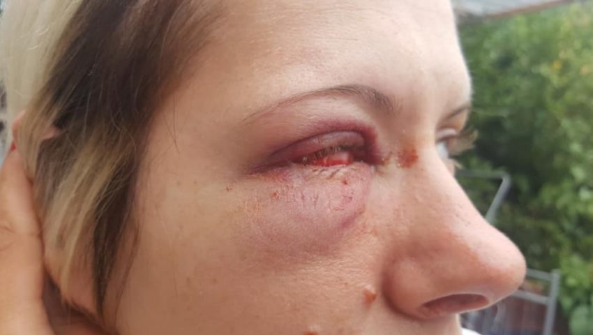 Brutalny atak na Polkę w Wielkiej Brytanii. Dostała za to, że jest z Polski!