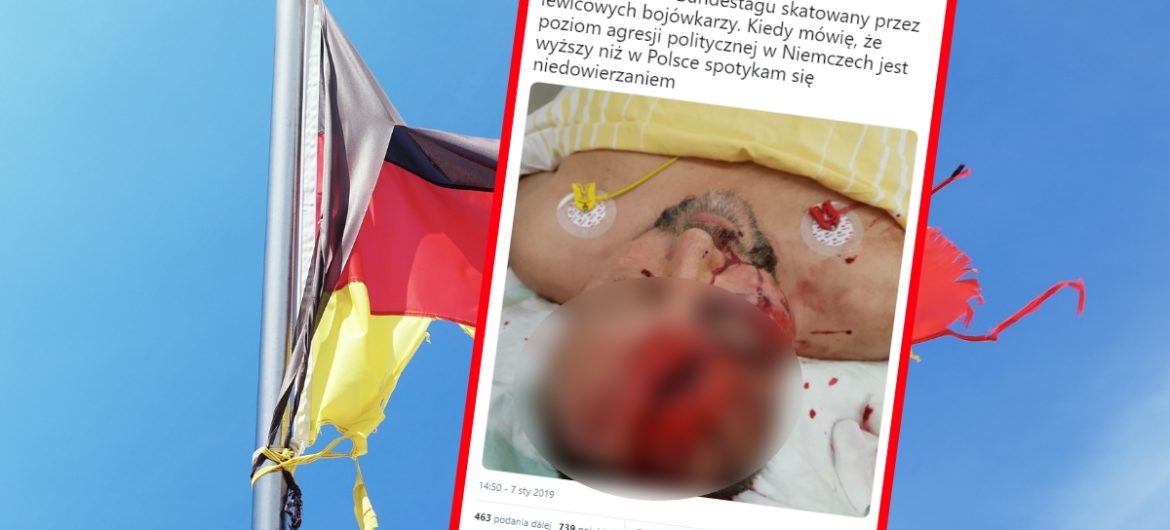 Lewicowi bojówkarze skatowali posła konserwatywnej partii. “To był zamach na jego życie”