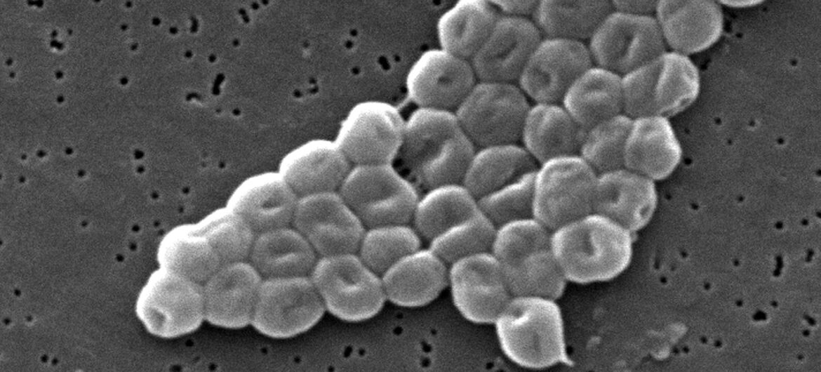 Naukowcy użyli sztucznej inteligencji by znaleźć antybiotyk na groźną bakterię