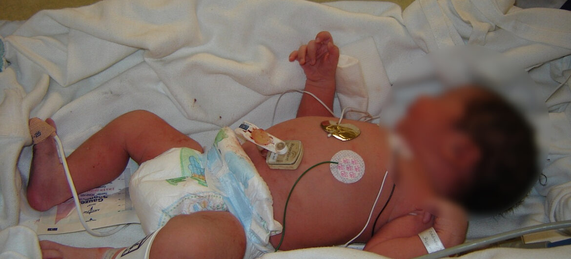 Szpital dziecięcy w Olsztynie pęka w szwach. Najmłodsi zmagają się z niebezpieczną chorobą dróg oddechowych