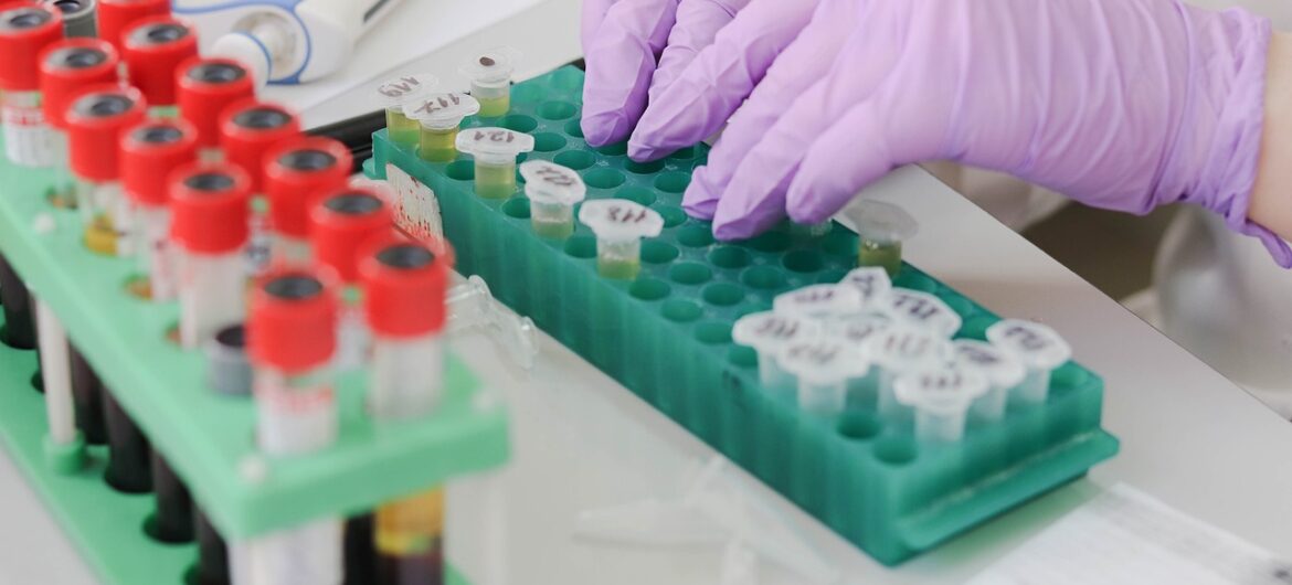 Tysiącom pacjentów podano krew z wirusem HIV i WZW. Teraz dostaną za to odszkodowania